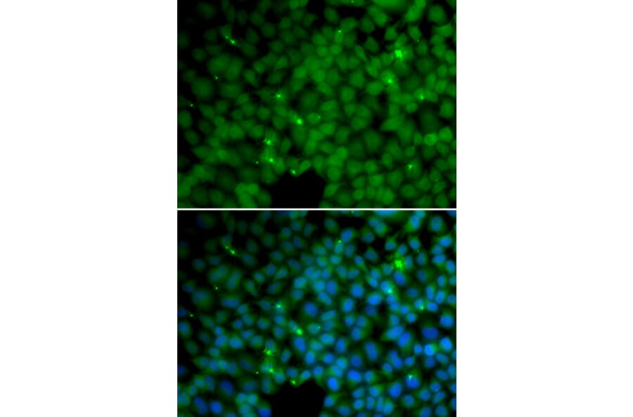 Immunofluorescence - GGH antibody from Signalway Antibody (38660) - Antibodies.com