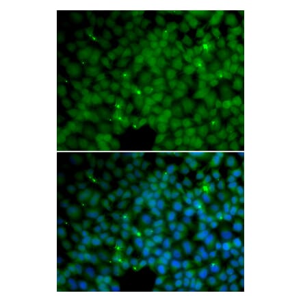 Immunofluorescence - GGH antibody from Signalway Antibody (38660) - Antibodies.com