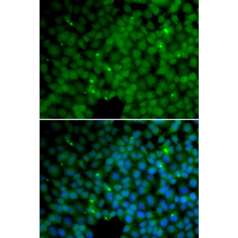 Immunofluorescence - GGH antibody from Signalway Antibody (38660) - Antibodies.com