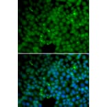 Immunofluorescence - GGH antibody from Signalway Antibody (38660) - Antibodies.com