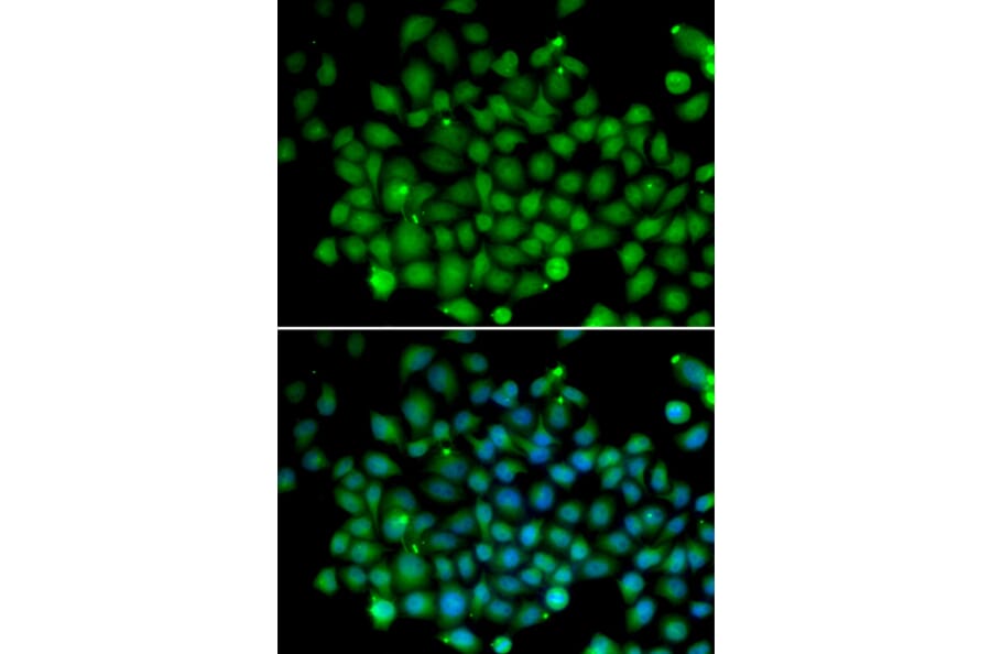 Immunofluorescence - UBD antibody from Signalway Antibody (38663) - Antibodies.com