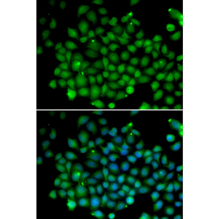 Immunofluorescence - UBD antibody from Signalway Antibody (38663) - Antibodies.com