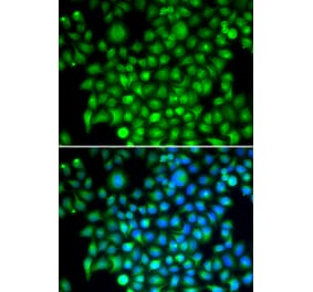Immunofluorescence - CFI antibody from Signalway Antibody (38676) - Antibodies.com