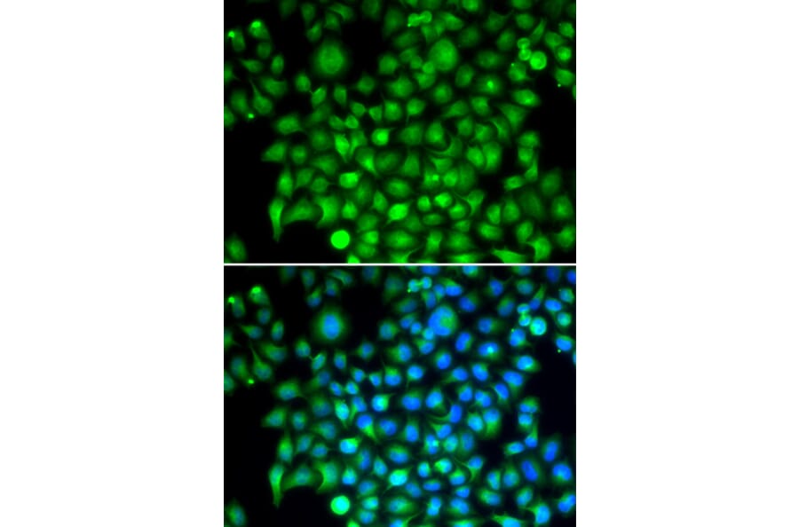 Immunofluorescence - CFI antibody from Signalway Antibody (38676) - Antibodies.com