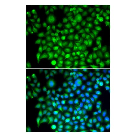 Immunofluorescence - CFI antibody from Signalway Antibody (38676) - Antibodies.com