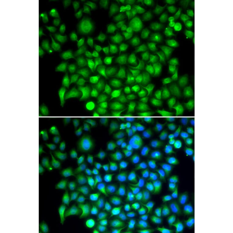 Immunofluorescence - CFI antibody from Signalway Antibody (38676) - Antibodies.com