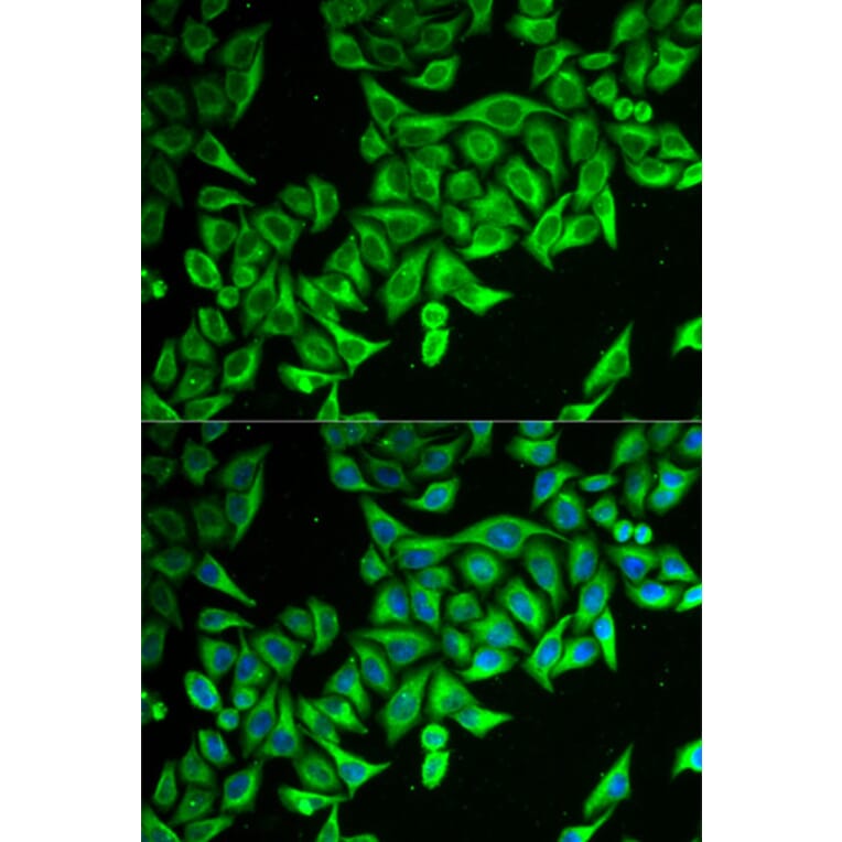Immunofluorescence - DAP antibody from Signalway Antibody (38736) - Antibodies.com
