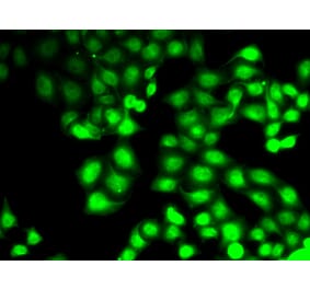Immunofluorescence - GCK antibody from Signalway Antibody (38800) - Antibodies.com