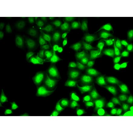 Immunofluorescence - GCK antibody from Signalway Antibody (38800) - Antibodies.com