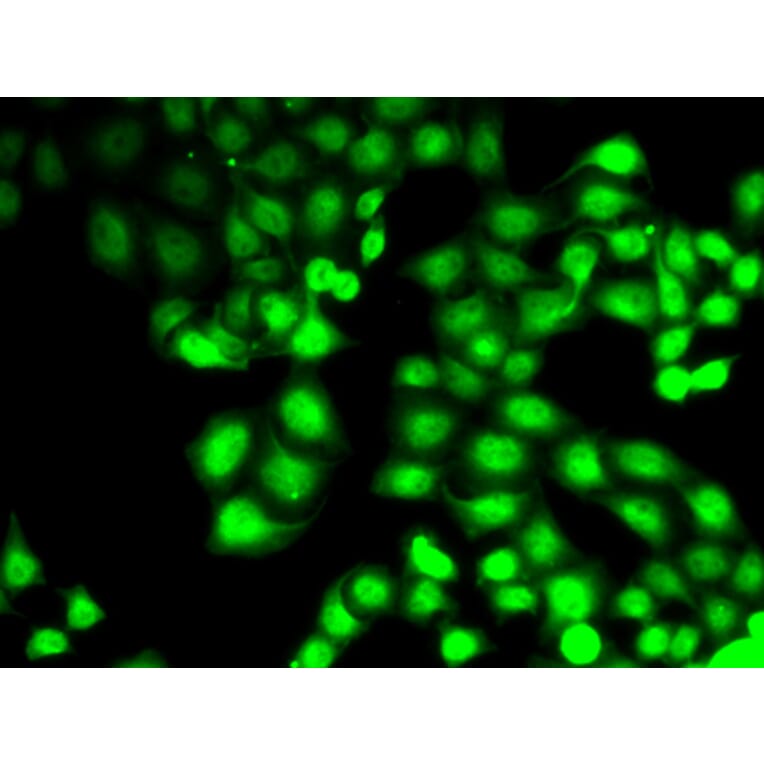 Immunofluorescence - GCK antibody from Signalway Antibody (38800) - Antibodies.com