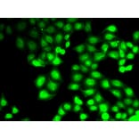 Immunofluorescence - GCK antibody from Signalway Antibody (38800) - Antibodies.com