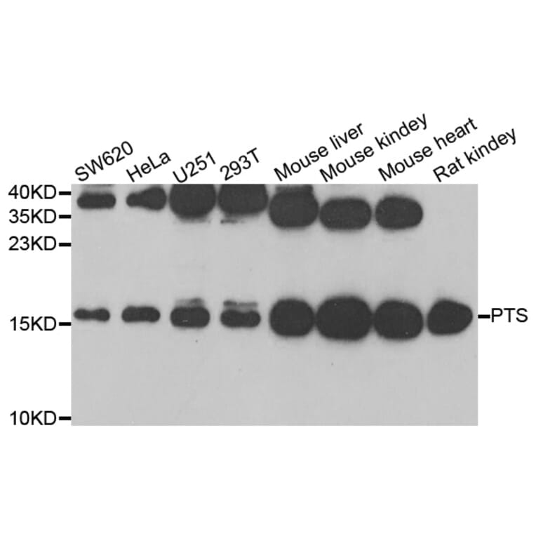 Western blot - PTS antibody from Signalway Antibody (38811) - Antibodies.com