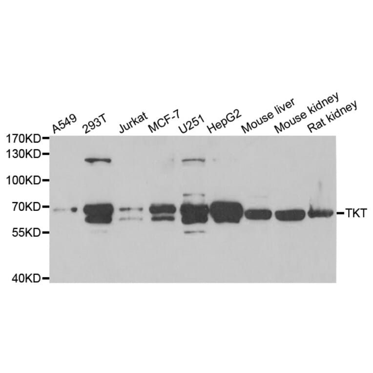 Western blot - TKT antibody from Signalway Antibody (38817) - Antibodies.com