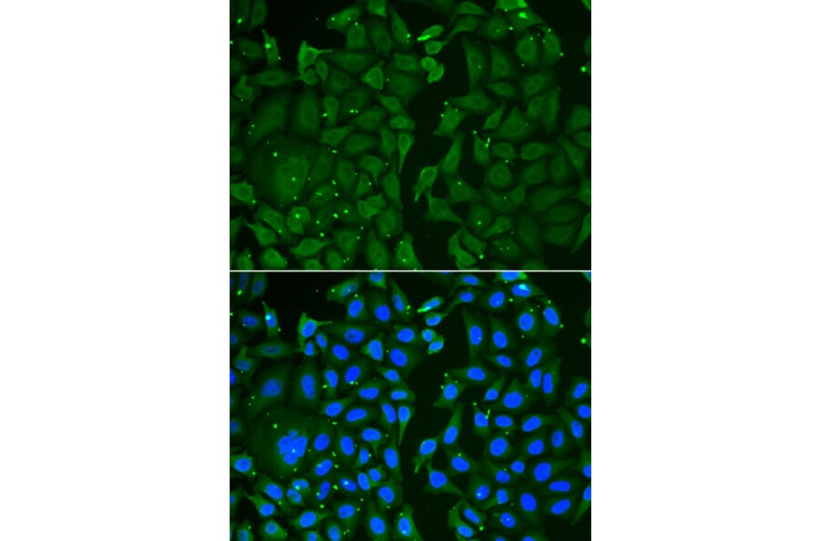 Immunofluorescence - TKT antibody from Signalway Antibody (38817) - Antibodies.com
