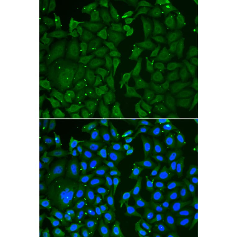 Immunofluorescence - TKT antibody from Signalway Antibody (38817) - Antibodies.com