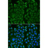 Immunofluorescence - TKT antibody from Signalway Antibody (38817) - Antibodies.com