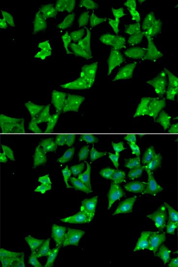 Anti-AGA Antibody (A39132) | Antibodies.com