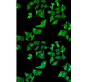 Immunofluorescence - AGA antibody from Signalway Antibody (38840) - Antibodies.com