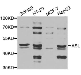Western blot - ASL antibody from Signalway Antibody (38844) - Antibodies.com