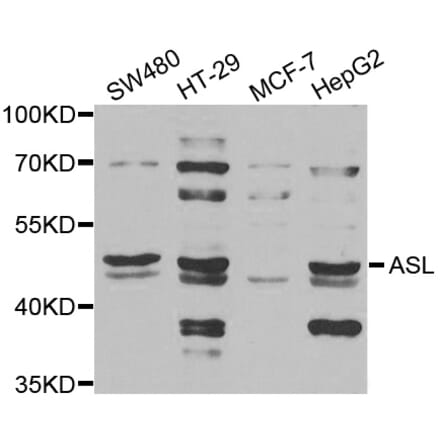Western blot - ASL antibody from Signalway Antibody (38844) - Antibodies.com