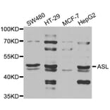 Western blot - ASL antibody from Signalway Antibody (38844) - Antibodies.com