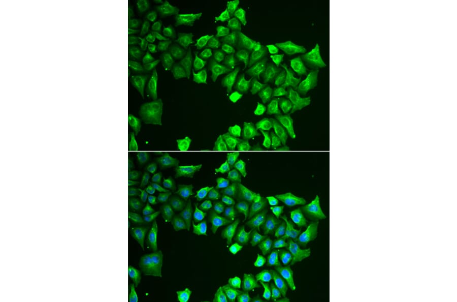 Immunofluorescence - ASL antibody from Signalway Antibody (38844) - Antibodies.com