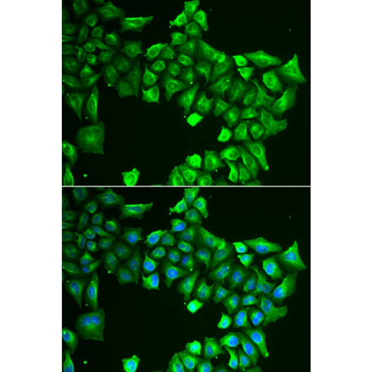 Immunofluorescence - ASL antibody from Signalway Antibody (38844) - Antibodies.com