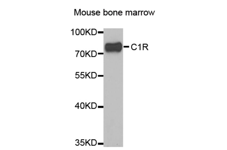 Western blot - C1R antibody from Signalway Antibody (38846) - Antibodies.com
