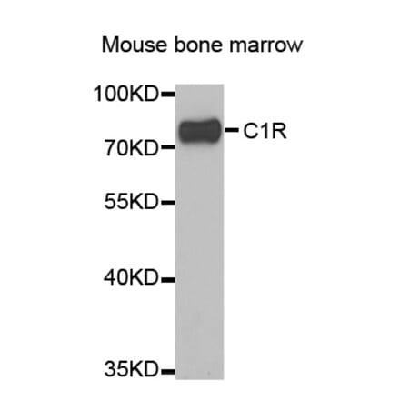 Western blot - C1R antibody from Signalway Antibody (38846) - Antibodies.com