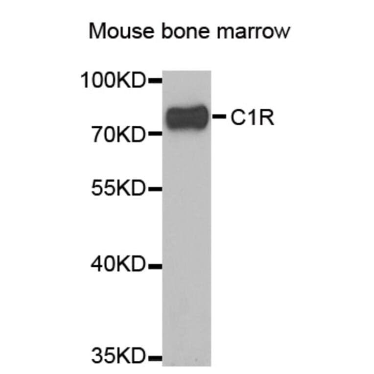 Western blot - C1R antibody from Signalway Antibody (38846) - Antibodies.com