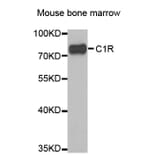 Western blot - C1R antibody from Signalway Antibody (38846) - Antibodies.com