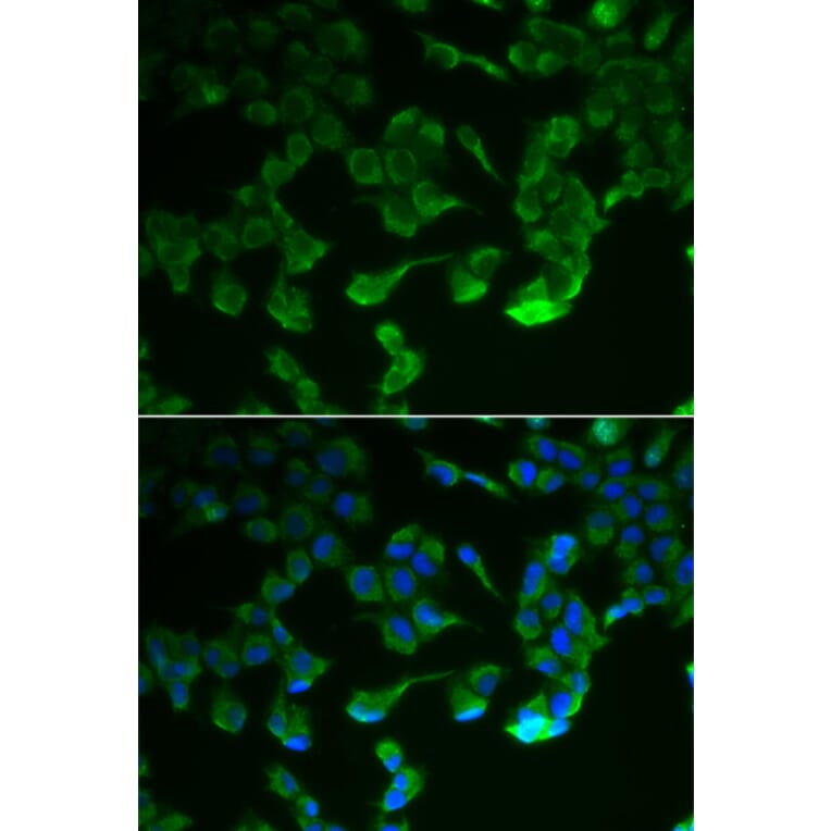 Immunofluorescence - C1R antibody from Signalway Antibody (38846) - Antibodies.com