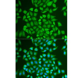 Immunofluorescence - PIP antibody from Signalway Antibody (38874) - Antibodies.com