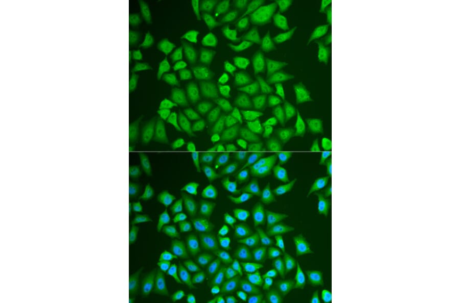 Immunofluorescence - PIP antibody from Signalway Antibody (38874) - Antibodies.com