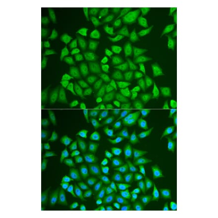 Immunofluorescence - PIP antibody from Signalway Antibody (38874) - Antibodies.com