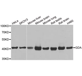 Western blot - GDA antibody from Signalway Antibody (38919) - Antibodies.com