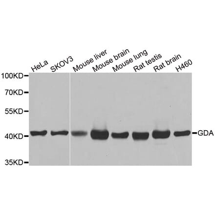 Western blot - GDA antibody from Signalway Antibody (38919) - Antibodies.com