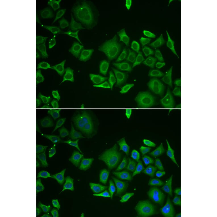 Immunofluorescence - C1D antibody from Signalway Antibody (38926) - Antibodies.com