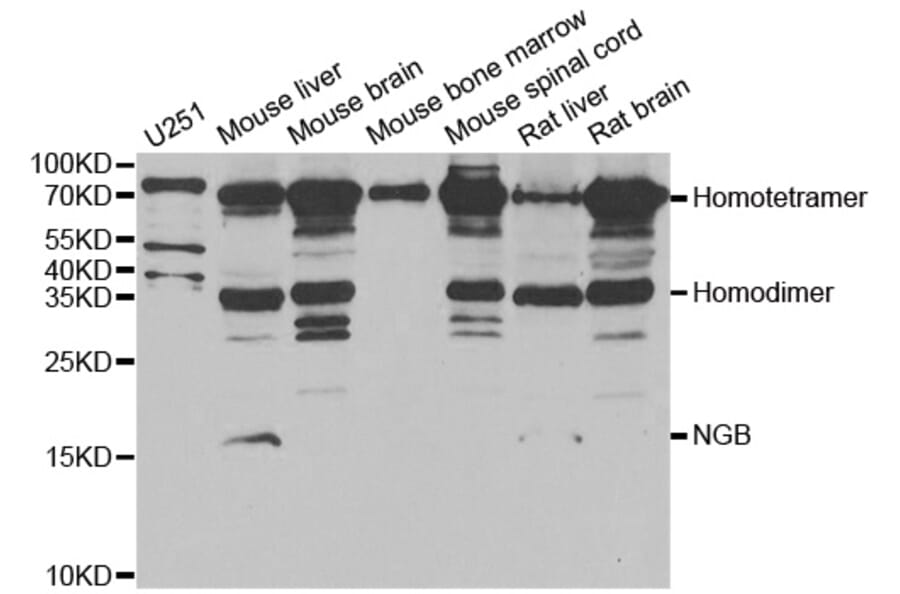 Western blot - NGB antibody from Signalway Antibody (38950) - Antibodies.com