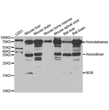 Western blot - NGB antibody from Signalway Antibody (38950) - Antibodies.com