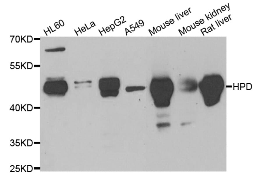 Western blot - HPD antibody from Signalway Antibody (38968) - Antibodies.com