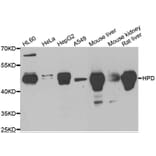 Western blot - HPD antibody from Signalway Antibody (38968) - Antibodies.com