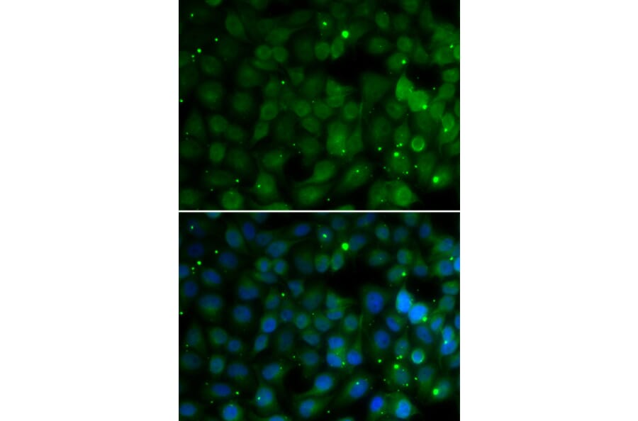 Immunofluorescence - HPD antibody from Signalway Antibody (38968) - Antibodies.com