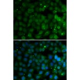 Immunofluorescence - HPD antibody from Signalway Antibody (38968) - Antibodies.com