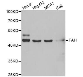 Western blot - FAH antibody from Signalway Antibody (39026) - Antibodies.com