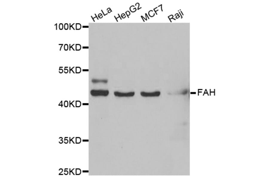 Western blot - FAH antibody from Signalway Antibody (39026) - Antibodies.com