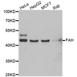 Western blot - FAH antibody from Signalway Antibody (39026) - Antibodies.com