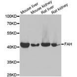 Western blot - FAH antibody from Signalway Antibody (39026) - Antibodies.com