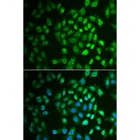 Immunofluorescence - FAH antibody from Signalway Antibody (39026) - Antibodies.com