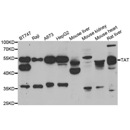 Western blot - TAT antibody from Signalway Antibody (39162) - Antibodies.com